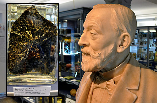 a bust of German pathologist Rudolf Virchow; inset - specimen of a coal miner's lung that Virchow had dissected at the Charity Hospital